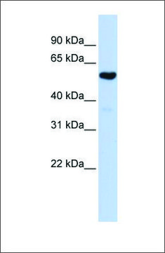 Anti-QRSL1 antibody produced in rabbit