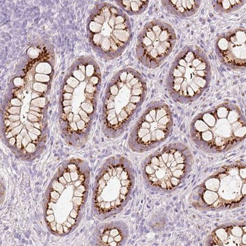Anti-PDXDC1 antibody produced in rabbit
