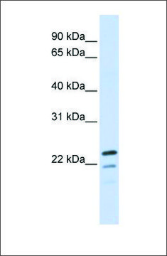 Anti-REEP1 antibody produced in rabbit