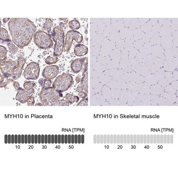 Anti-MYH10 antibody produced in rabbit