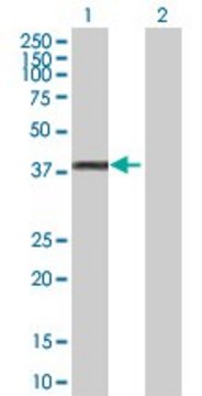 Anti-GYG1 antibody produced in rabbit