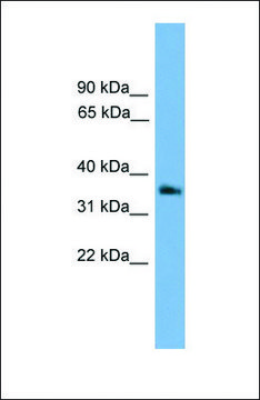 Anti-GNB4 antibody produced in rabbit