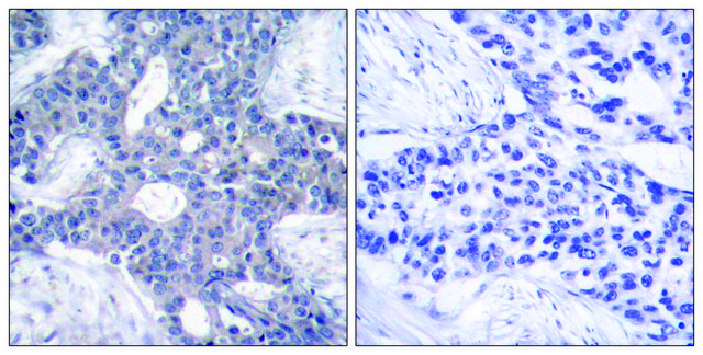 Anti-ZAP-70, antibody produced in rabbit