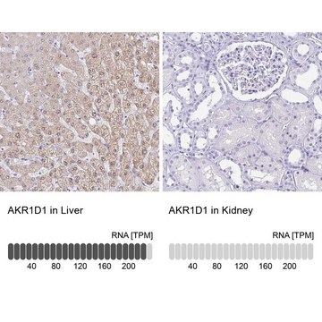 Anti-AKR1D1 antibody produced in rabbit