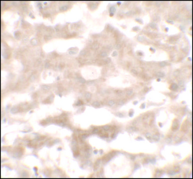 Anti-VNN3 antibody produced in rabbit
