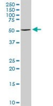 Anti-TYR antibody produced in rabbit