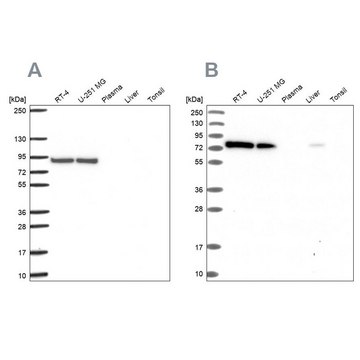 Anti-DYNC1I2 antibody produced in rabbit