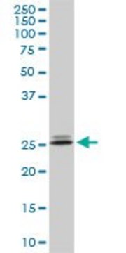 Monoclonal Anti-PHOSPHO1, (C-terminal) antibody produced