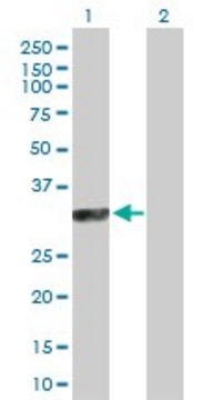 Anti-SYCP3 antibody produced in rabbit