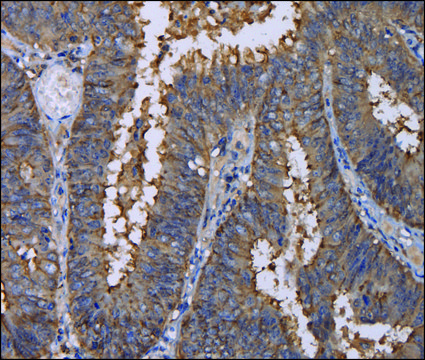 Anti-REG3G antibody produced in rabbit