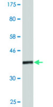 Monoclonal Anti-ASH2L antibody produced in