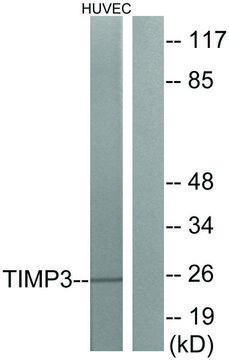 Anti-TIMP3 antibody produced in rabbit