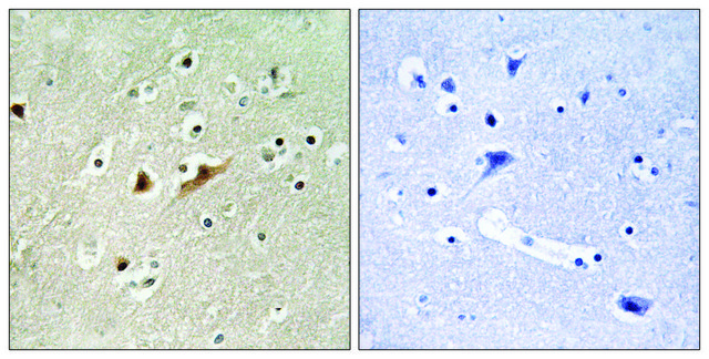 Anti-RGAP1 antibody produced in rabbit