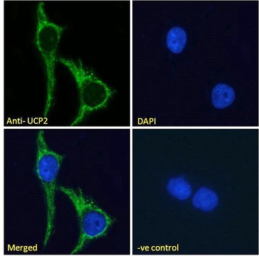 Anti-Uncoupling Protein 2/UCP2 antibody produced