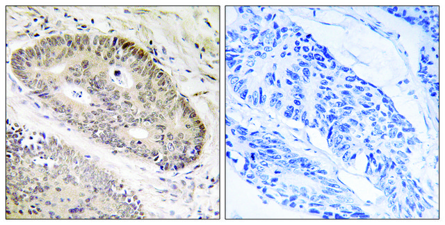Anti-ALS2CR8 antibody produced in rabbit