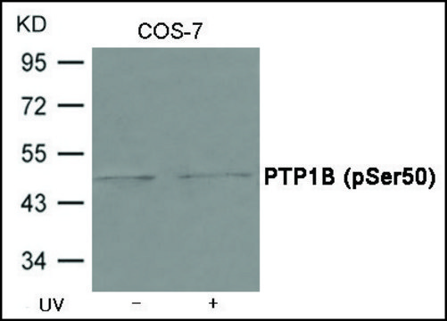Anti-phospho-PTP1B (pSer??) antibody produced in
