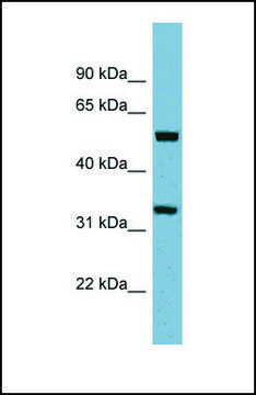 Anti-TMEM158 antibody produced in rabbit