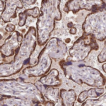 Anti-KLHL20 antibody produced in rabbit