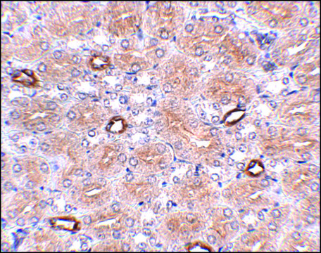 Anti-NOTUM antibody produced in rabbit
