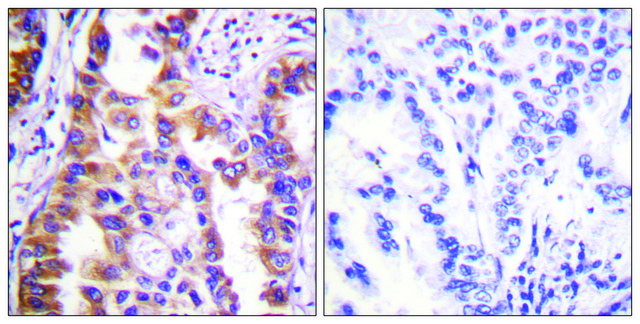 Anti-TSC2 antibody produced in rabbit