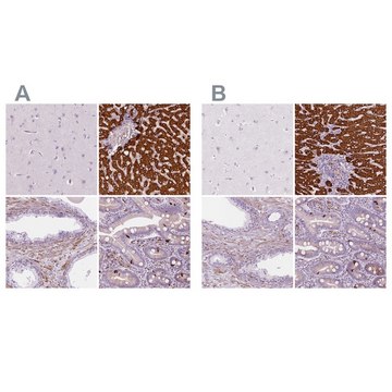Anti-CES1 antibody produced in rabbit