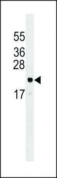ANTI-ARL6IP5 (CENTER) antibody produced in