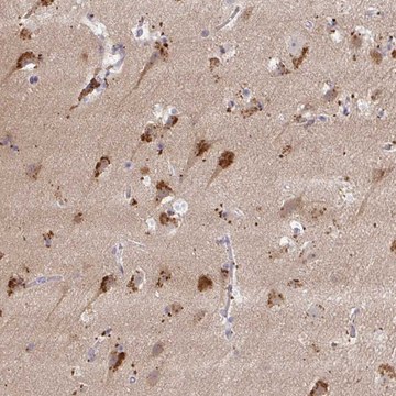 Anti-MAP1LC3A antibody produced in rabbit