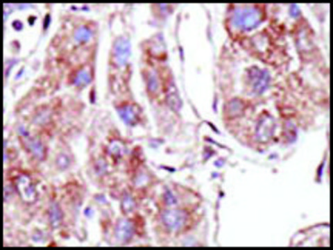 Anti-PIASz1 (C-term) antibody produced in