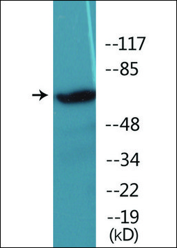 Anti-phospho-IRAK1 (pThr²??) antibody produced in