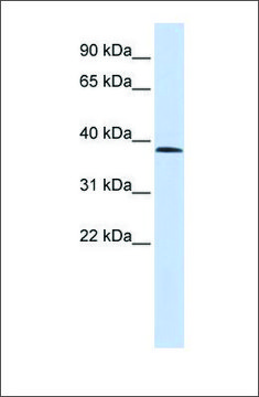 Anti-SUV420H1 (ab2) antibody produced in