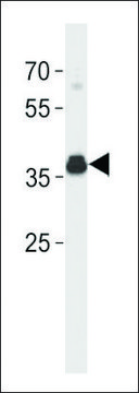 ANTI-ESR1 ISOFORM4 (C-TERM) antibody produced