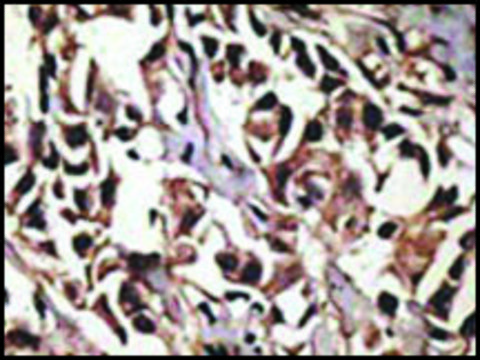 Anti-PRMT7 (C-term) antibody produced in