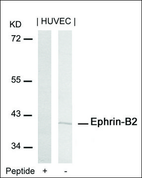 Anti-EFNB2 (Ab-316) antibody produced in