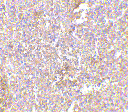 Anti-STEAP1 (ab2) antibody produced in