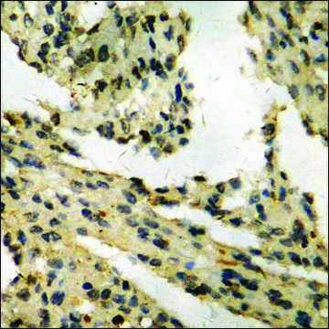 Anti-phospho-Retinoblastoma (pSer???) antibody produced in