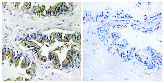 Anti-GSPT1 antibody produced in rabbit