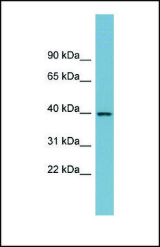 Anti-SULT2B1, (N-terminal) antibody produced in