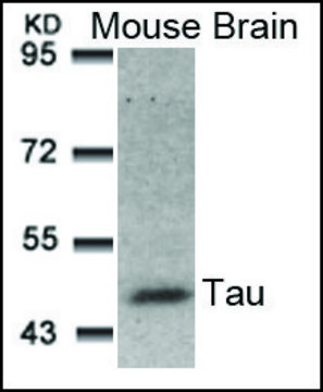 Anti-MAPT (Ab-181) antibody produced in