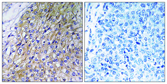 Anti-GOLT1A antibody produced in rabbit