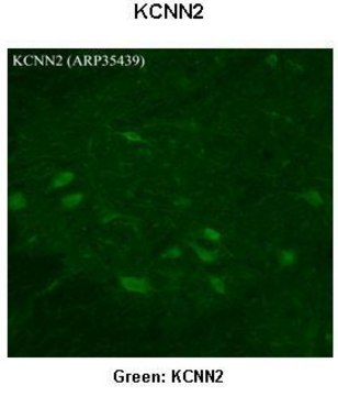 Anti-KCNN2 antibody produced in rabbit