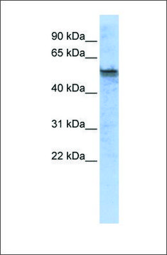 Anti-TPH2 antibody produced in rabbit