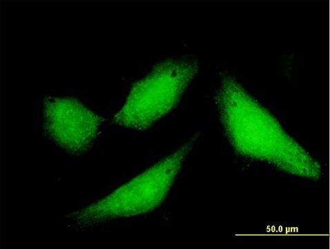 Anti-CPXCR1 antibody produced in mouse