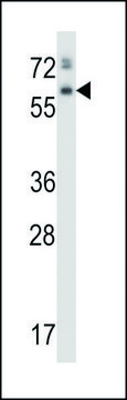 ANTI-ASPG (CENTER) antibody produced in