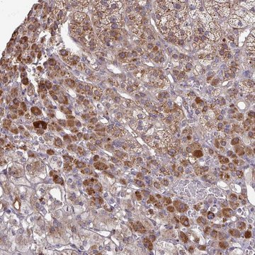 Anti-B4GALT6 antibody produced in rabbit