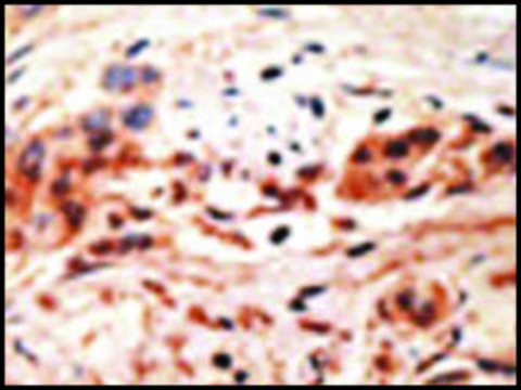 Anti-PHO1 (N-term) antibody produced in