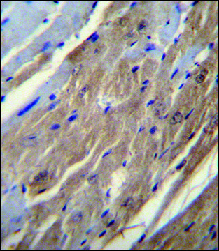 ANTI-FGF16 (N-TERM) antibody produced in