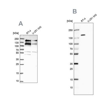 Anti-TOP2B antibody produced in rabbit