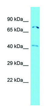 Anti-ACTR8 (N-terminal) antibody produced in