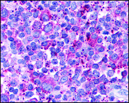 Anti-CX3CR1 antibody produced in rabbit