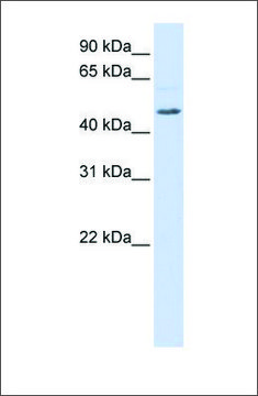 Anti-RGS11 antibody produced in rabbit